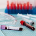 Closeup of full vials of blood placed on medical diaper near plastic eyeglasses and syringes and test tubes in container