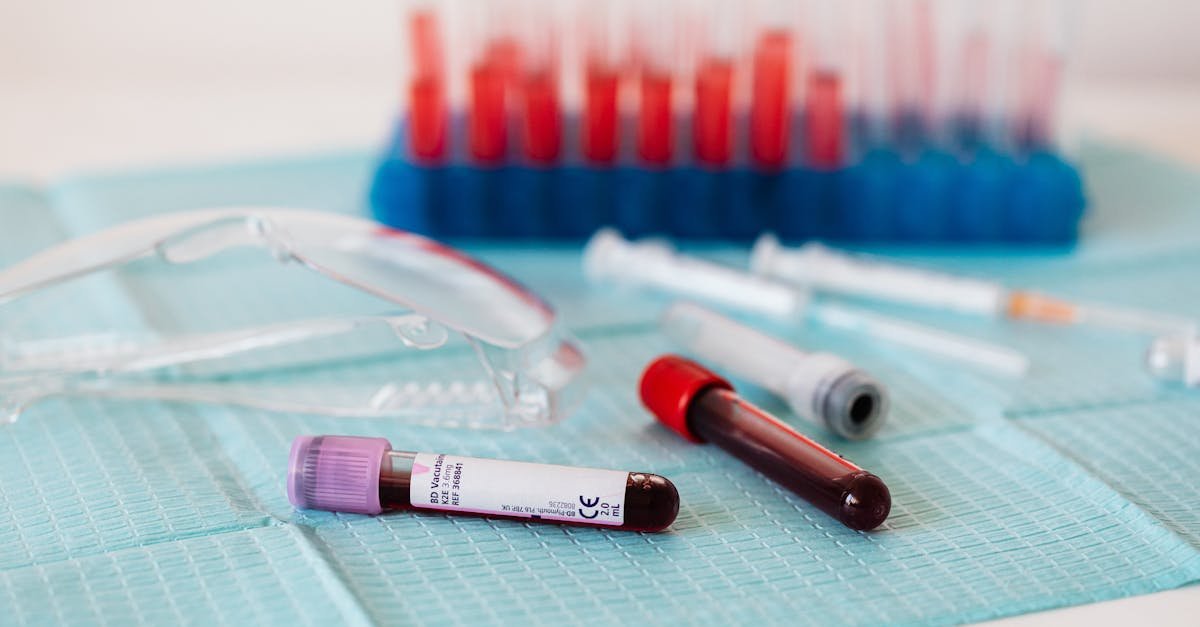 Closeup of full vials of blood placed on medical diaper near plastic eyeglasses and syringes and test tubes in container