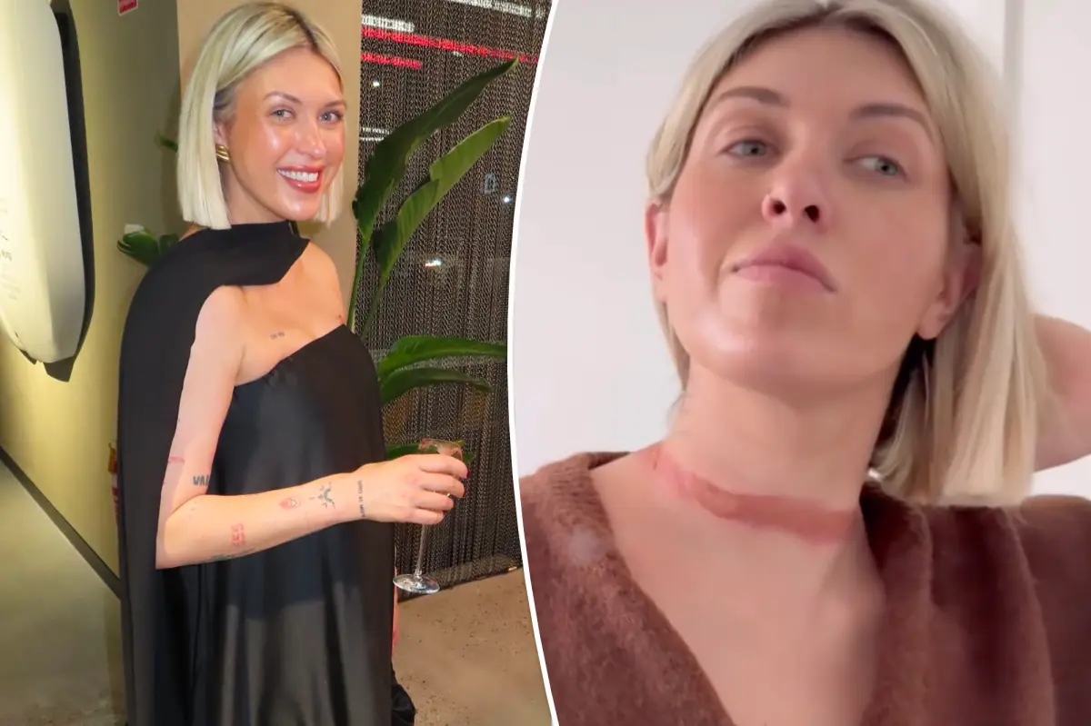 Fashion Influencer’s Scarf Mishap Sparks Safety Warning