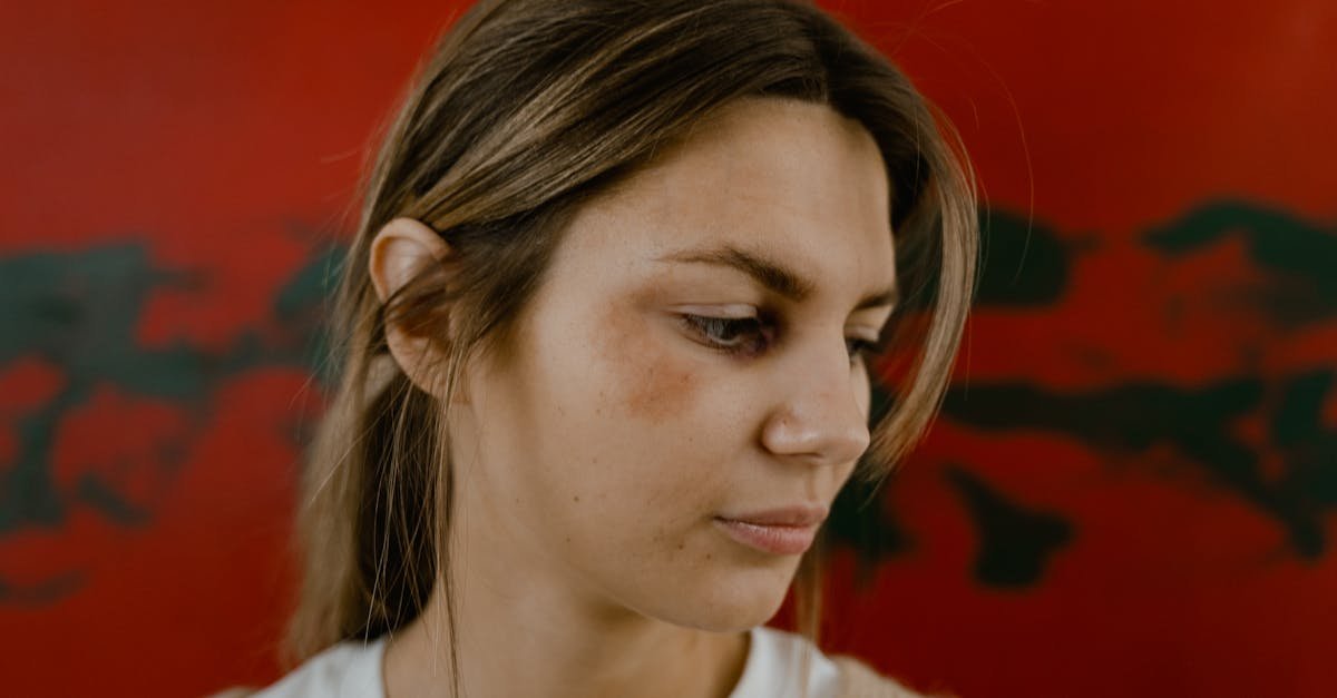 Close-up portrait of a woman with a bruised eye looking down, conveying emotion against a red backdrop.